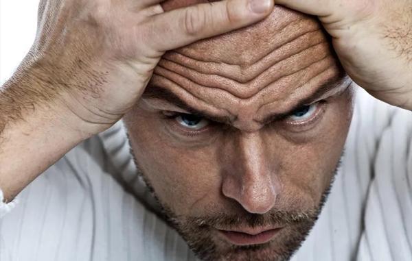 چروک و خطوط روی پیشانی در خصوص سلامت قلب خبر می دهند